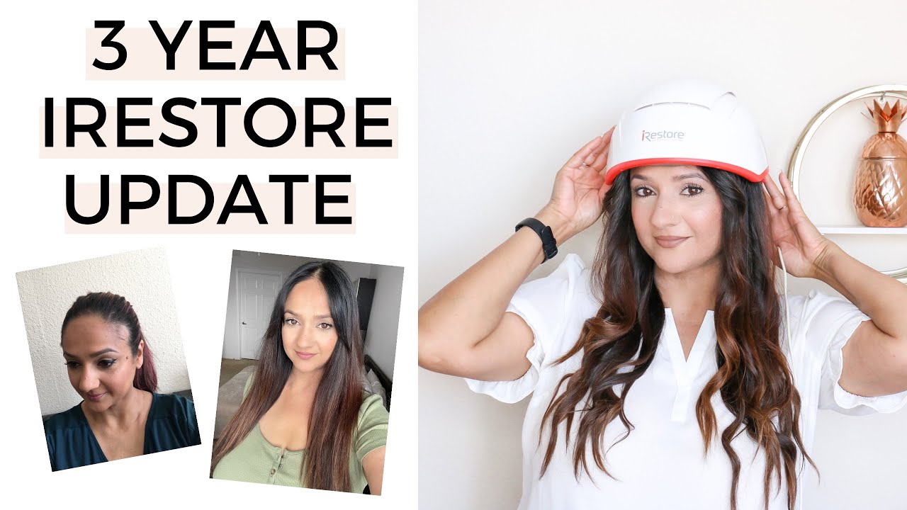 3 Year iRestore Review | My Results!