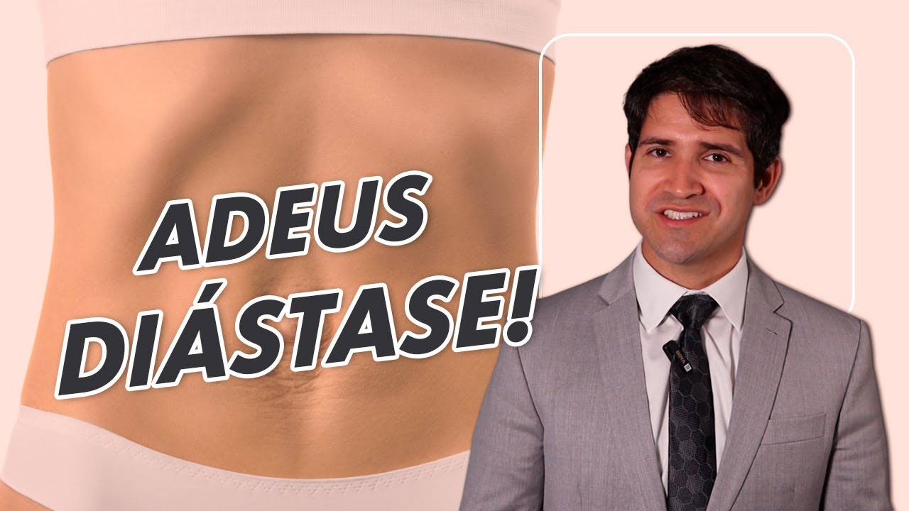 Como corrigir DI&Aacute;STASE ABDOMINAL com CIRURGIA | Dr Alexandre Andrade
