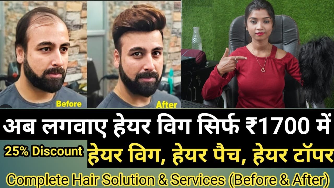 राँची में मात्र 1700₹ में लगाये असली बाल || Hair Patch Ranchi | हेयर विंग रांची | Wig Studio Ranchi