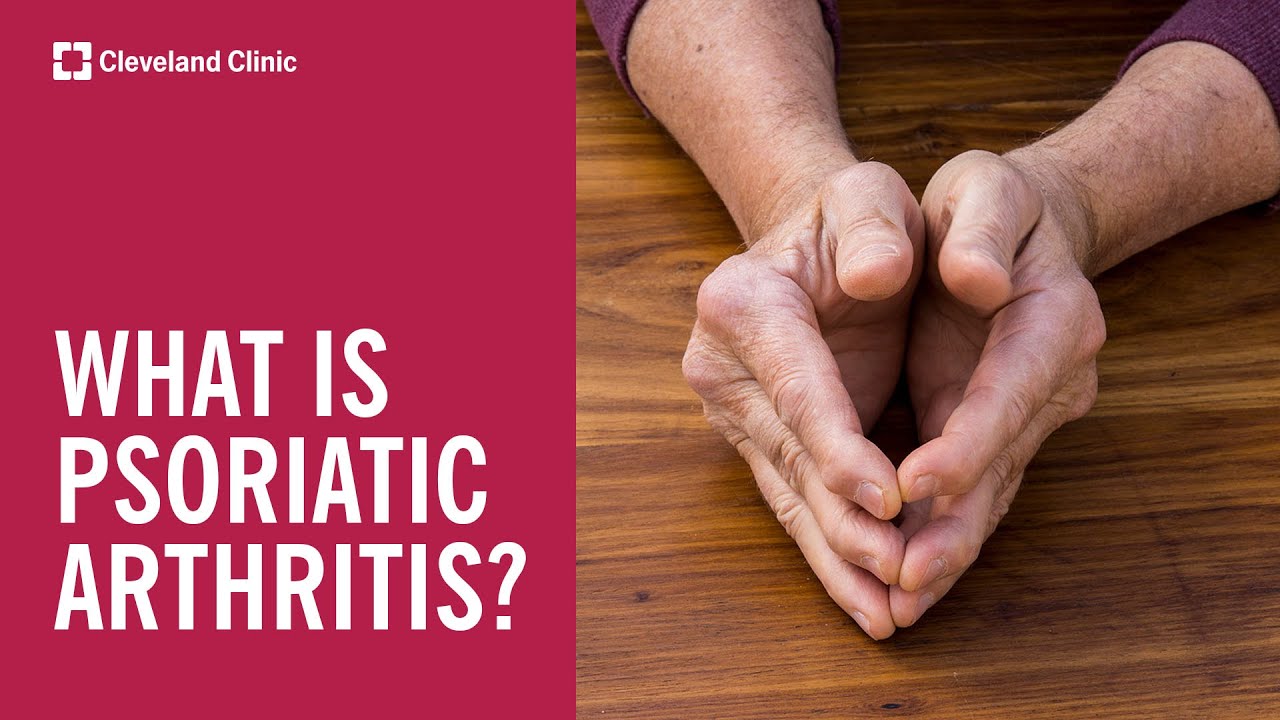 What Is Psoriatic Arthritis?