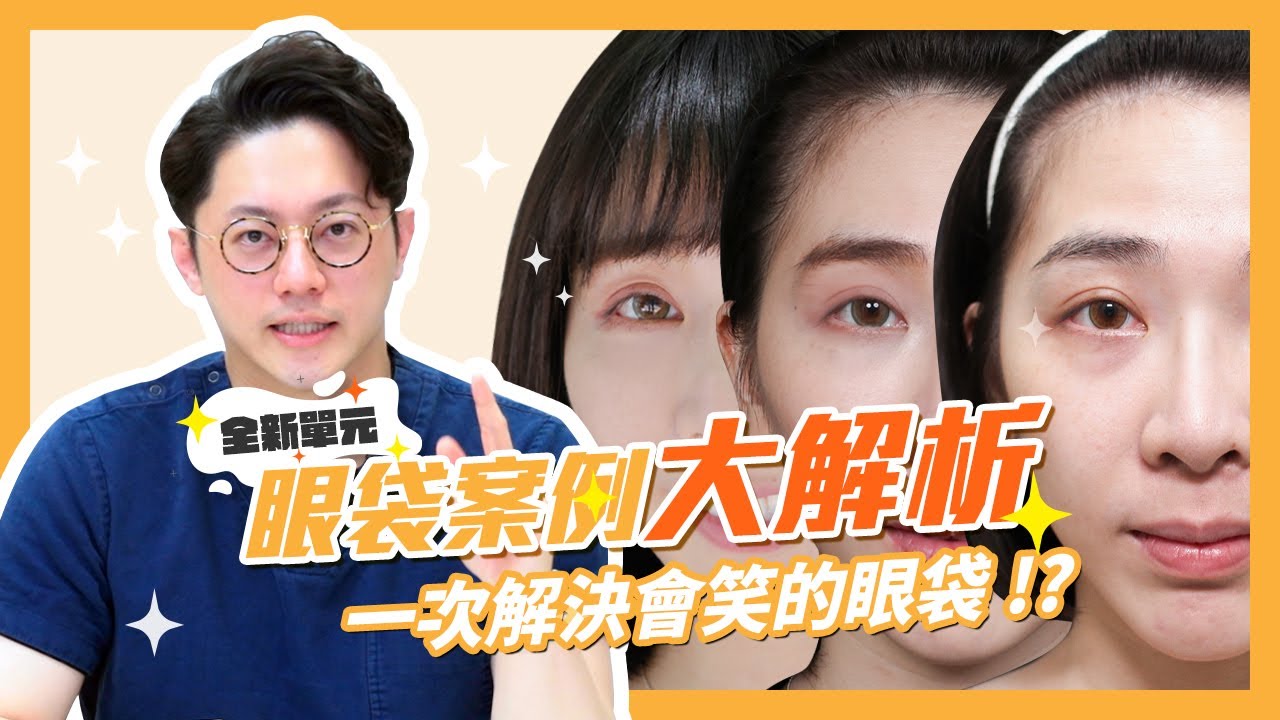 眼袋案例大解析！一次解決會笑的眼袋｜周杰醫師