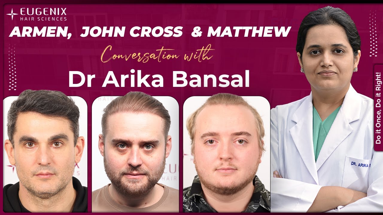 US & UK Patients Share Bald-to-Bold Transformations with Expert Opinions: Eugenix Hair Transplant