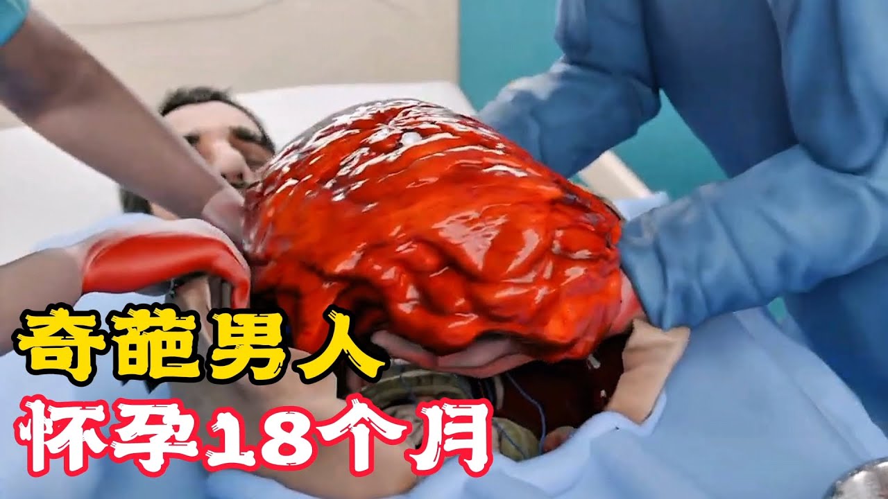 男人懷孕18個月，直到他看醫生，才發現闖了大禍！科普動畫《真男人懷孕》。電影，短片，成精，解說，搞笑，動畫，動作，喜劇，獵奇，奇幻，腦洞，科幻，超能力，short film