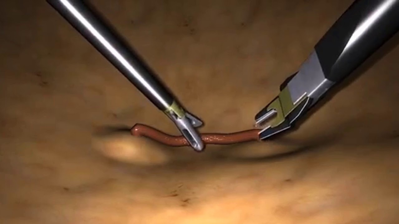 LAPSIM CERTIFICATION PROGRAM&trade; for GENERAL SURGERY