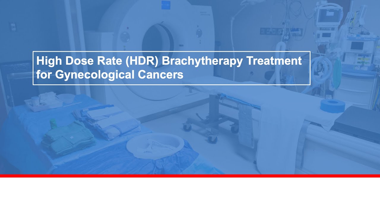 High dose rate (HDR) brachytherapy treatment for gynecological cancers