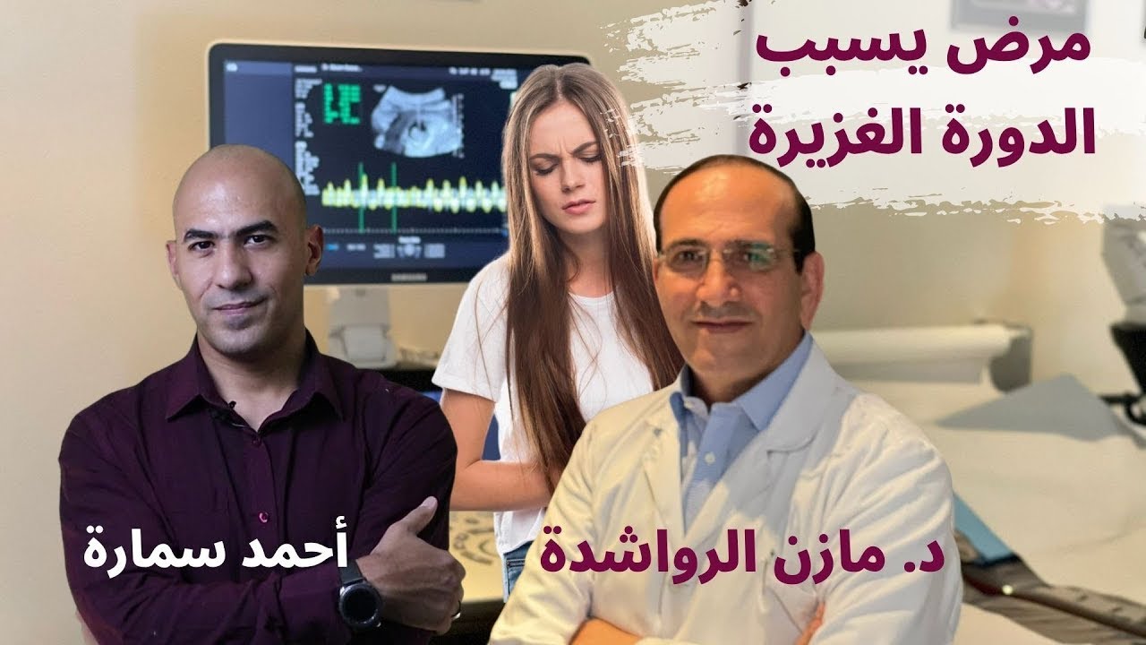 اعراض الورم الليفي - اعراض الورم الليفي في الرحم ومتى تكون الياف الرحم خطيرة