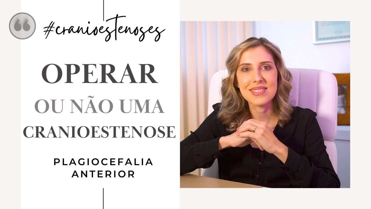 CRANIOESTENOSE: OPERAR OU NÃO? | Plagiocefalia Anterior | Dra. Clarice Abreu
