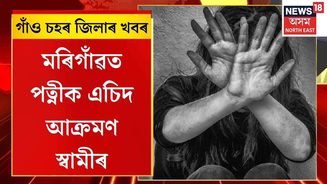 Assam News | মৰিগাঁৱৰ বৰথল কছাৰী গাঁৱত স্বামীগৃহলৈ নেযোৱাৰ বাবেই পত্নীক এচিদ ঢালি আক্ৰমণ স্বামীৰ |
