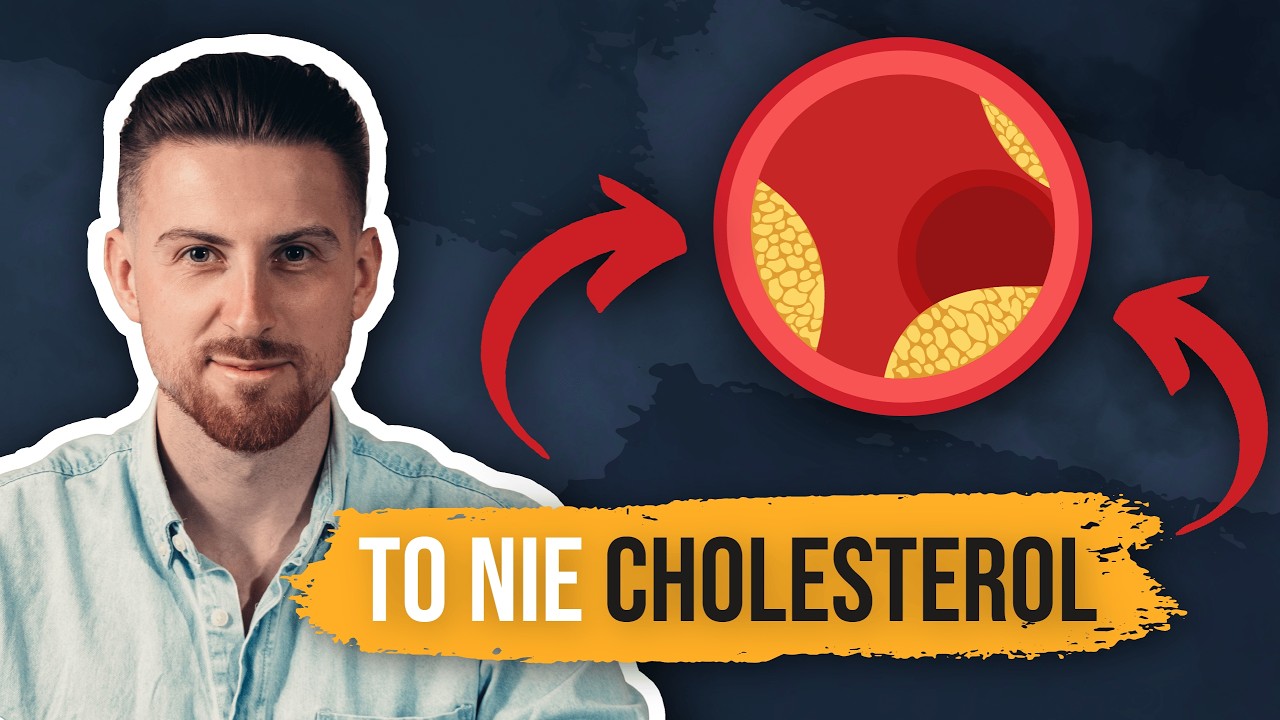 Poznaj prawdę o cholesterolu! Musisz to wiedzieć by uniknąć zawału i miażdżycy - nowoczesne badania