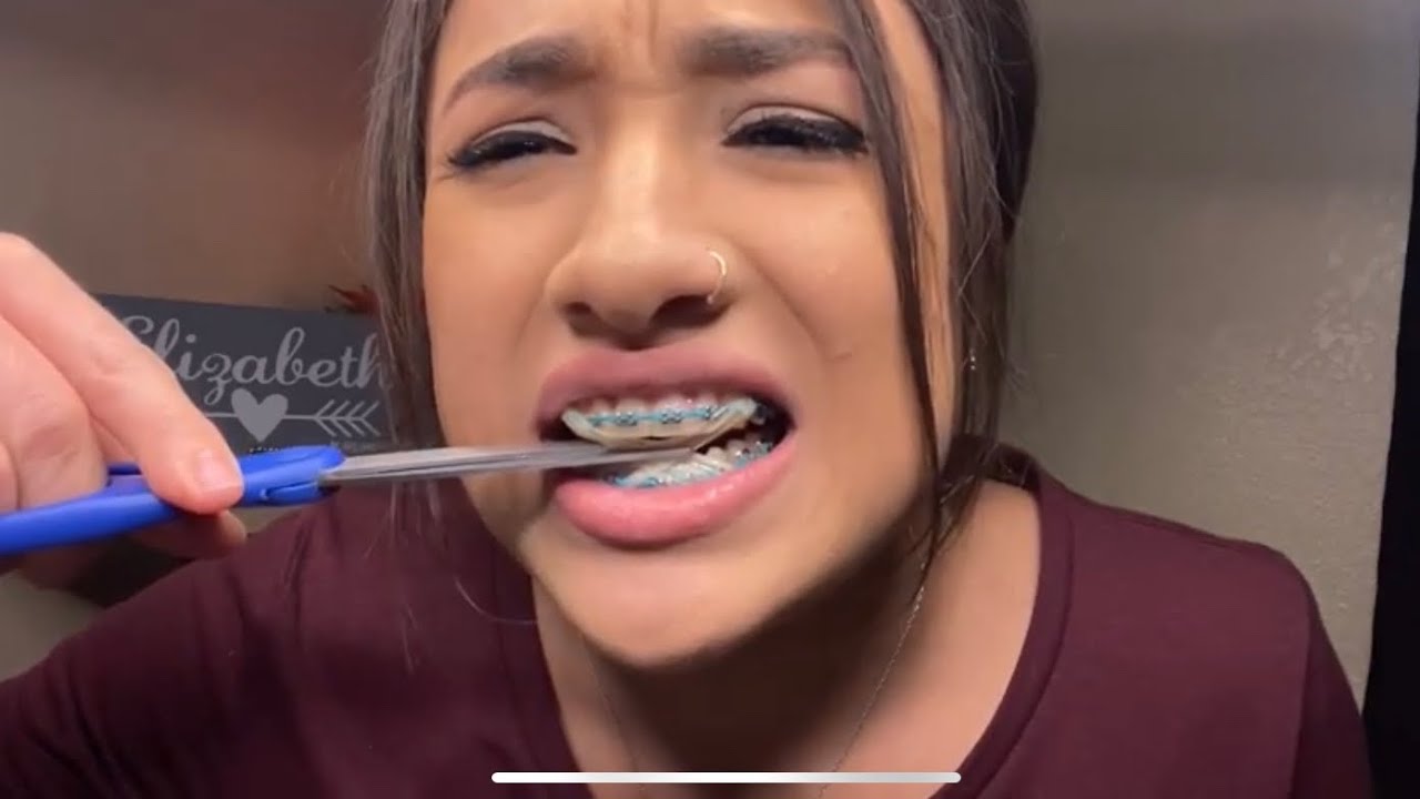 Butterfly Braces Challenge~DON’T TRY THIS