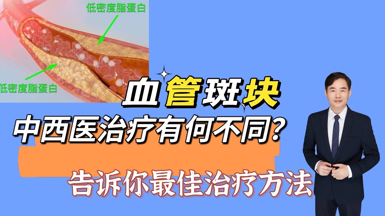 血管斑块，中西医治疗有啥不同？怎样治疗效果好？告诉你方法