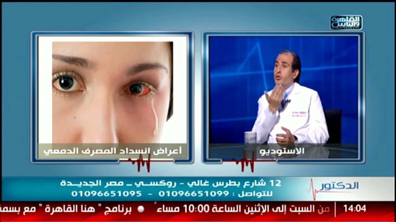 الدكتور | أعراض انسداد المصرف الدمعى وطرق علاجه مع دكتور ضياء عابدين