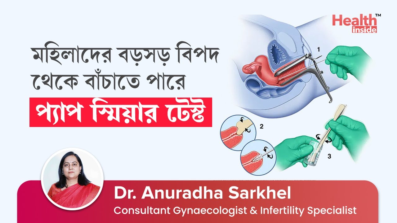 জরায়ুমুখের ক্যান্সার নির্ণয়ে প্যাপ স্মিয়ার টেস্ট | Pap Smear Test for cervical cancer screening