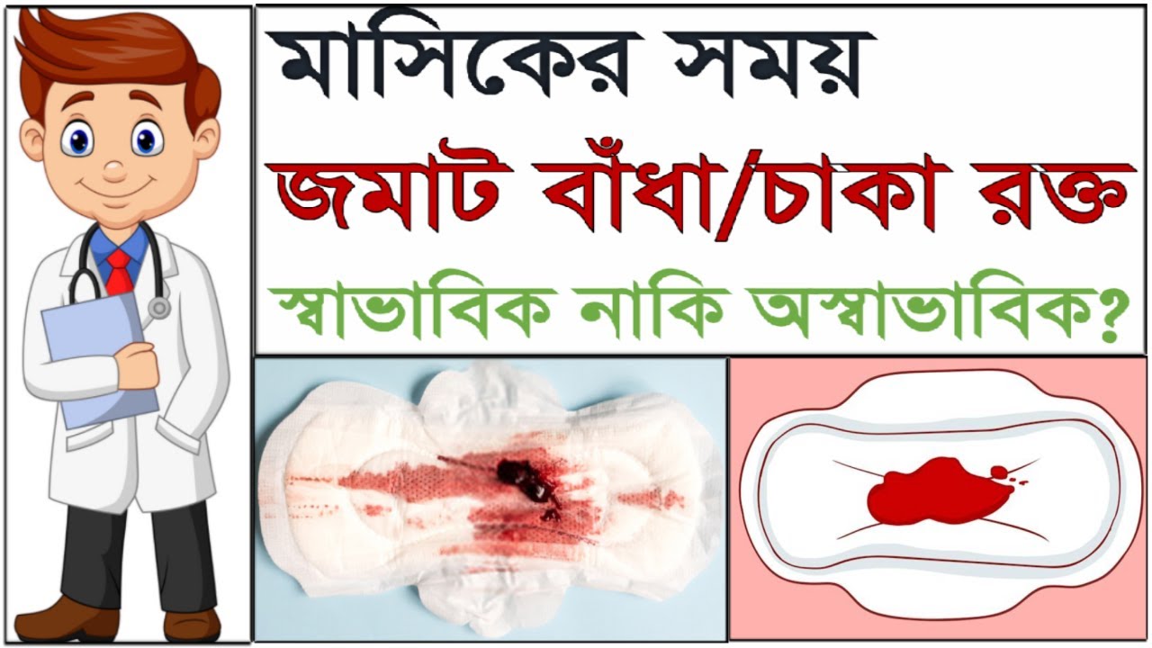 মাসিকের সময় জমাট বাধা রক্ত কেন আসে?এর লক্ষণ, চিকিৎসা ও মুক্তির উপায় কি?Blood clots in period Bangla.