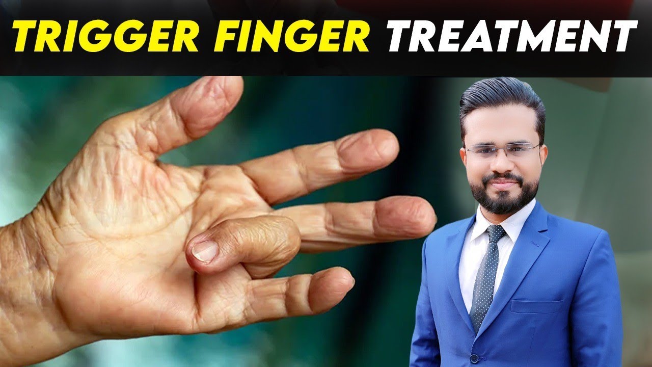 Trigger Finger Treatment | Exercises for Trigger Finger | Exercises for Fingers | Dr. Noman Awan PT