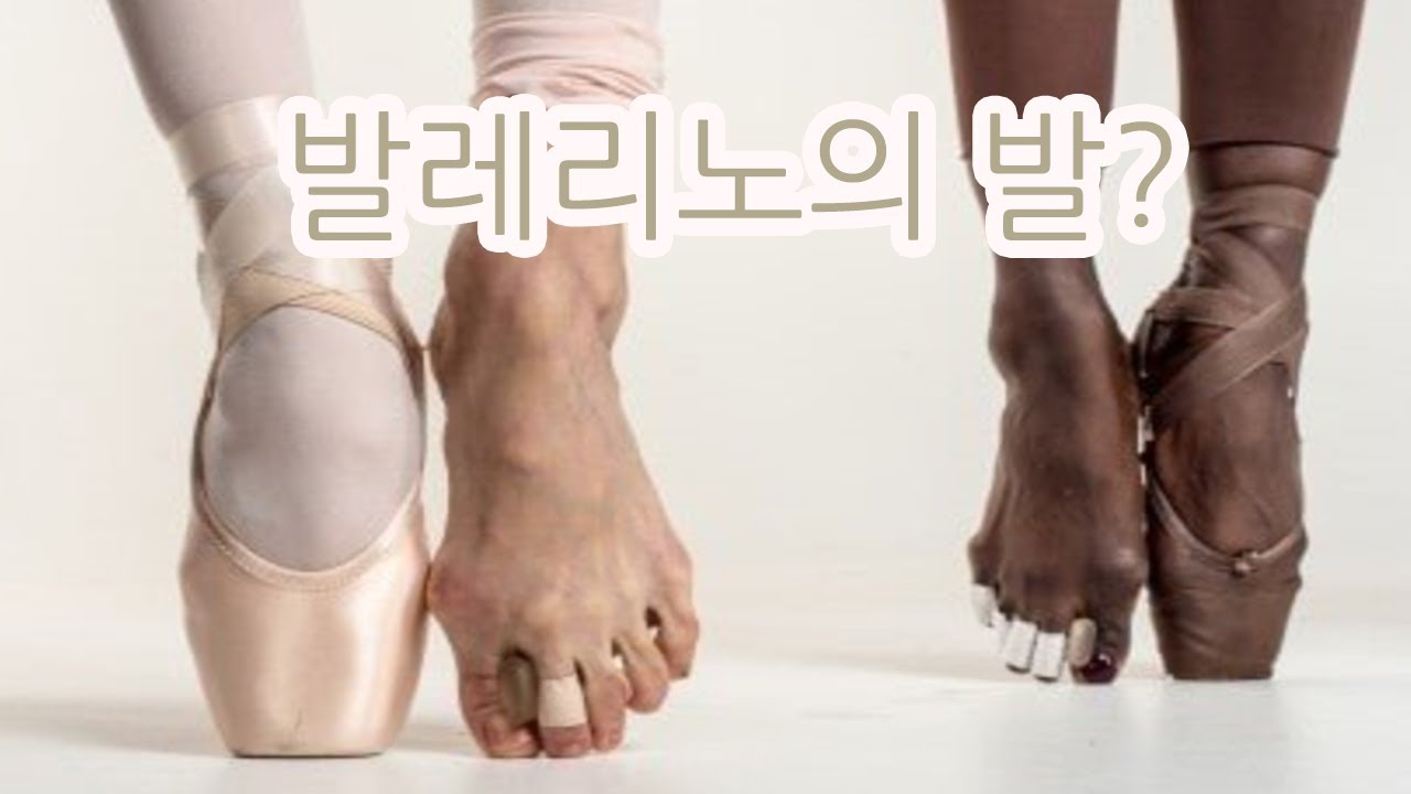 발레리노 발 진짜 이럴까? [발레리나 발 번외편] 두두리노,DOODOORINO ballet