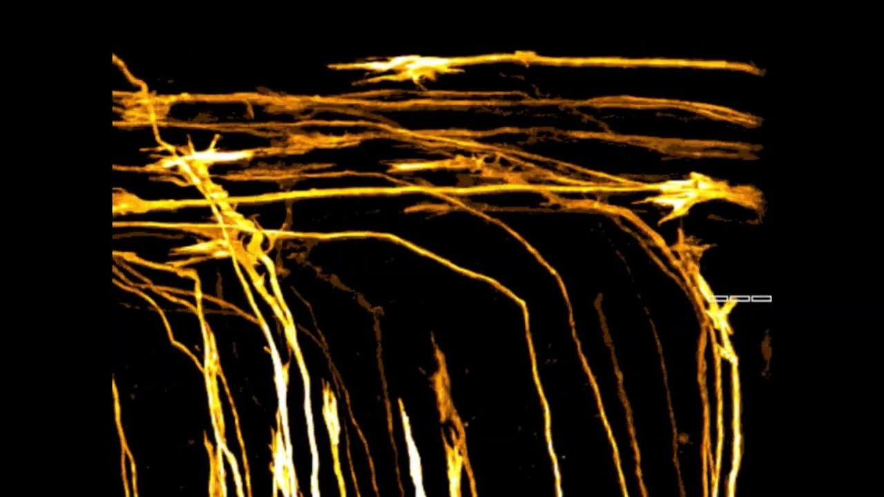 Commissural axons crossing the CNS midline and turning rostrally during neural development