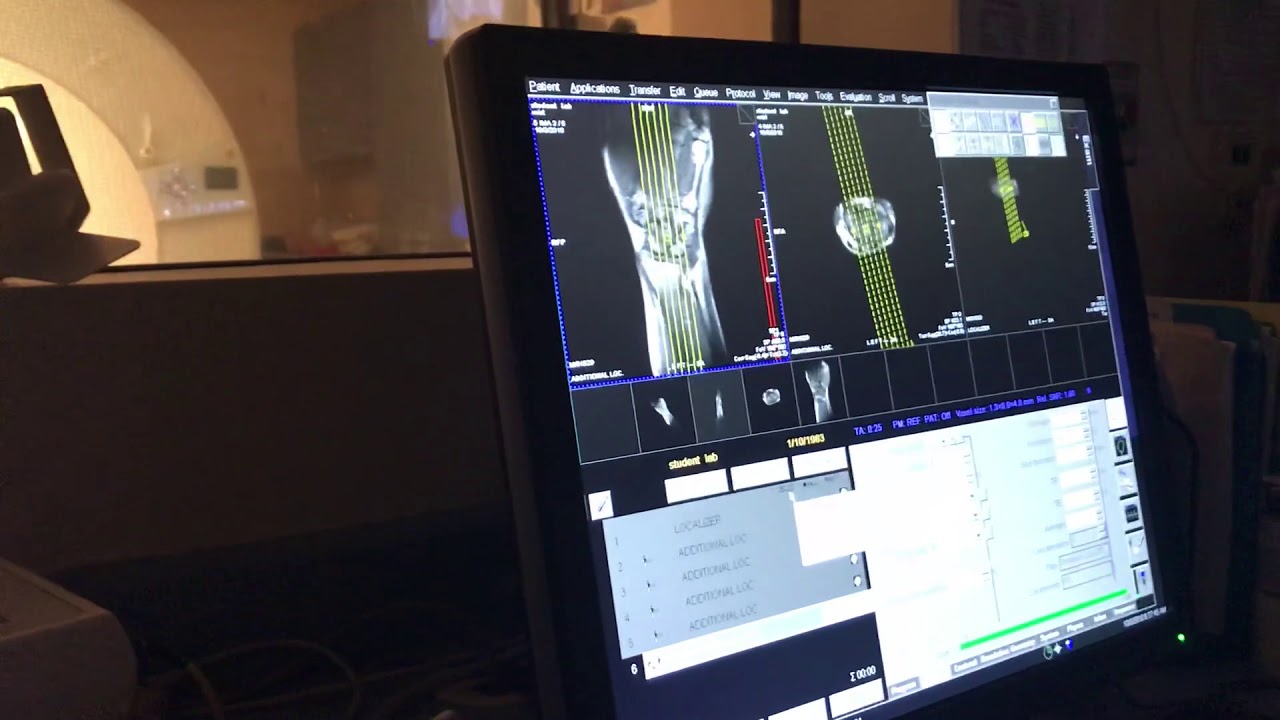 School of Medical Imaging MRI Lab Wrist - How to Localize