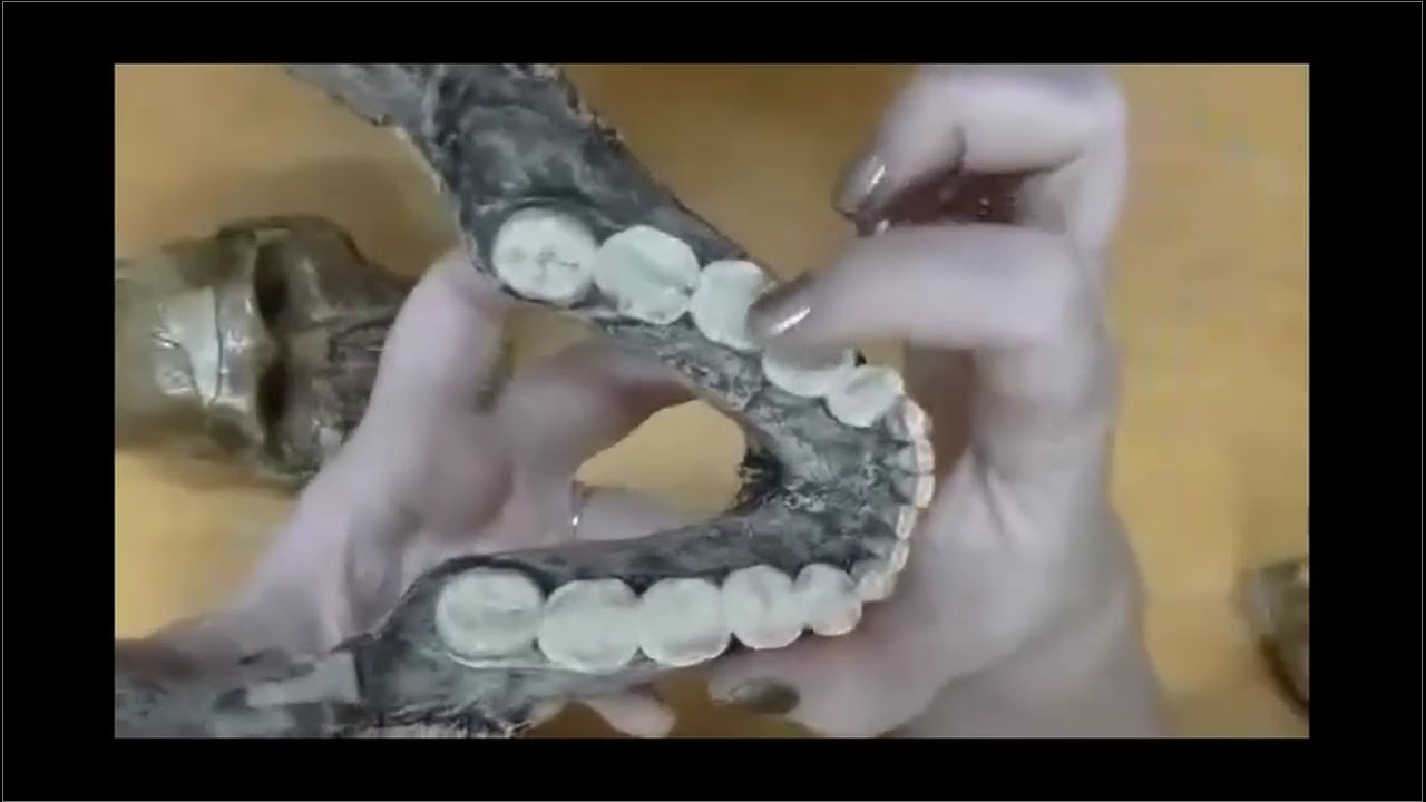 Australopithecines