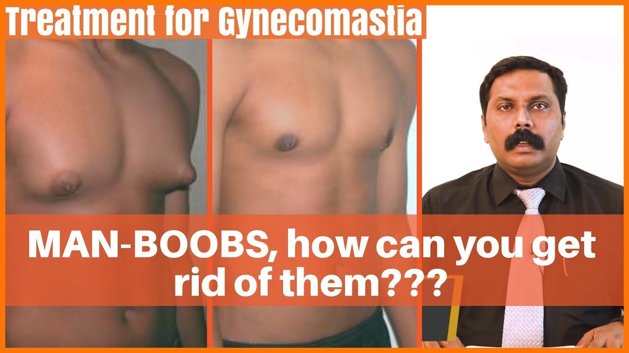 What is Gynecomastia and how common is it? Gynecomastia Man Boobs | Dr. Sunil Kumar KS, MHW