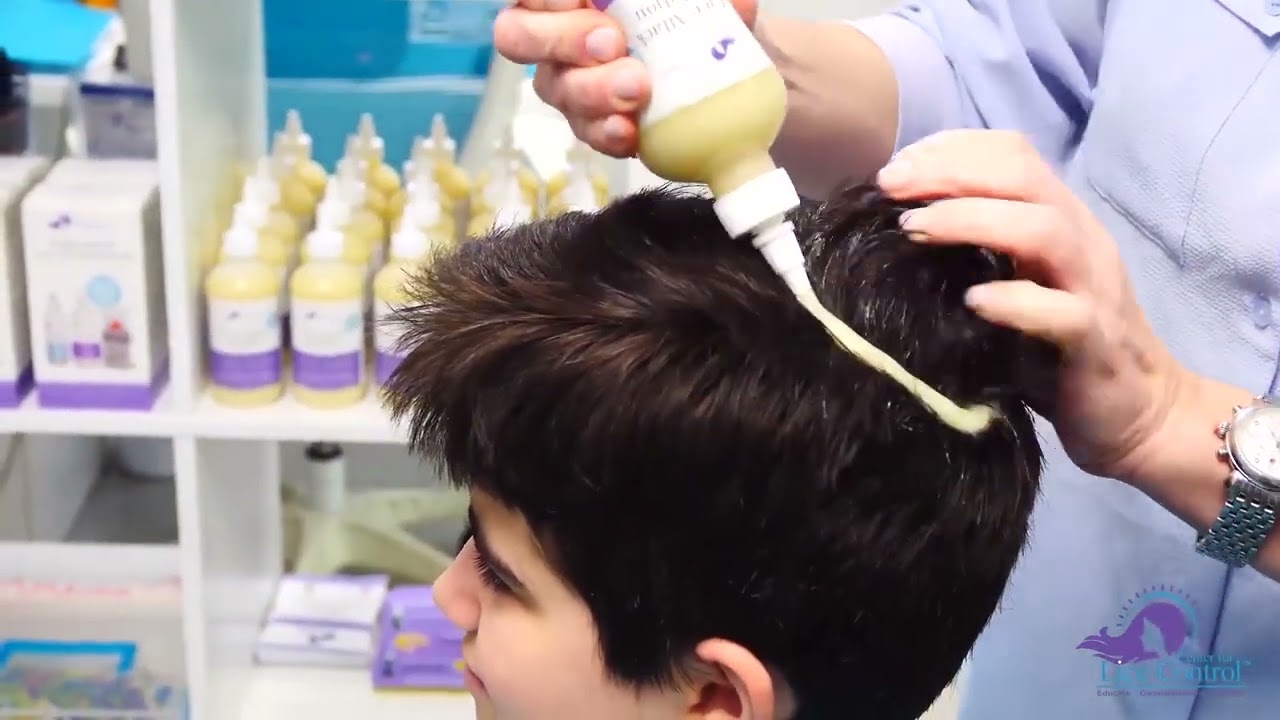 Apply Lice Attack Solution to Short Hair