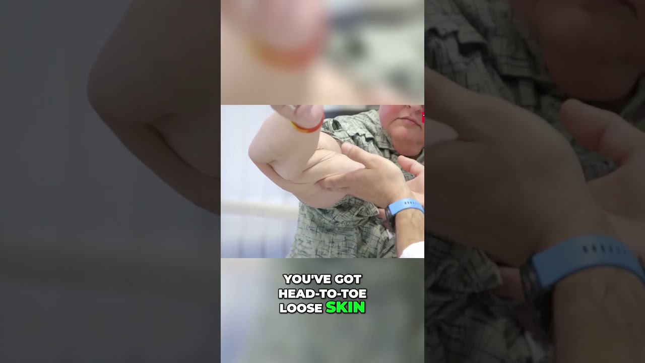 1000-lb Sisters: Tammy Slaton's Huge Weight Loss Gives Her Loose Skin 