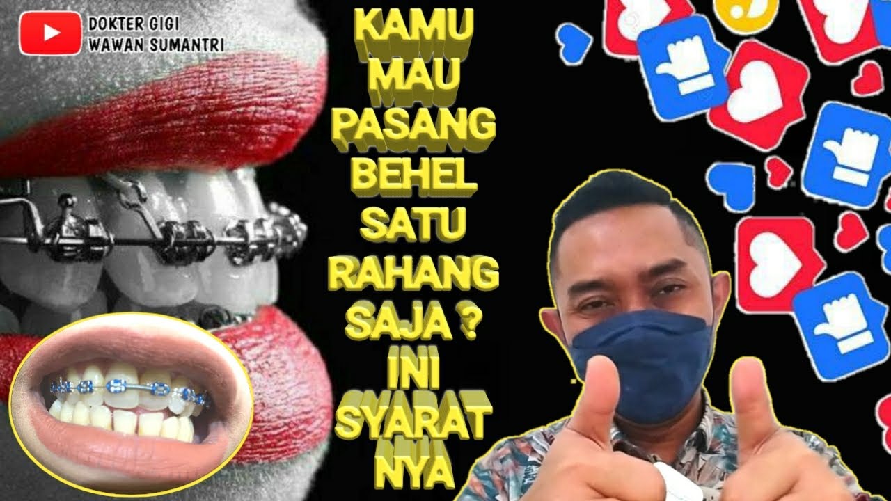 PASANG BEHEL SATU RAHANG SAJA BOLEH NGGAK SIH DOK ⁉️ #pasangbehel #behelgigi #kawatgigi #dentist