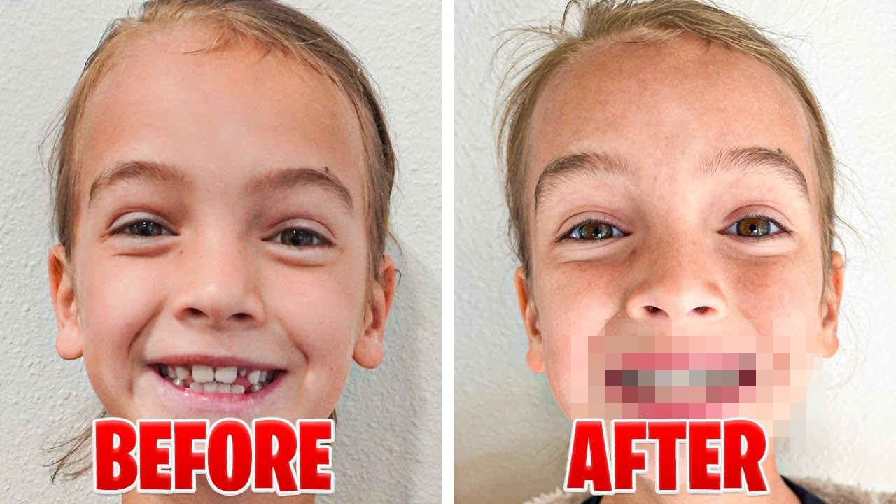 Cora Got BRACES!!