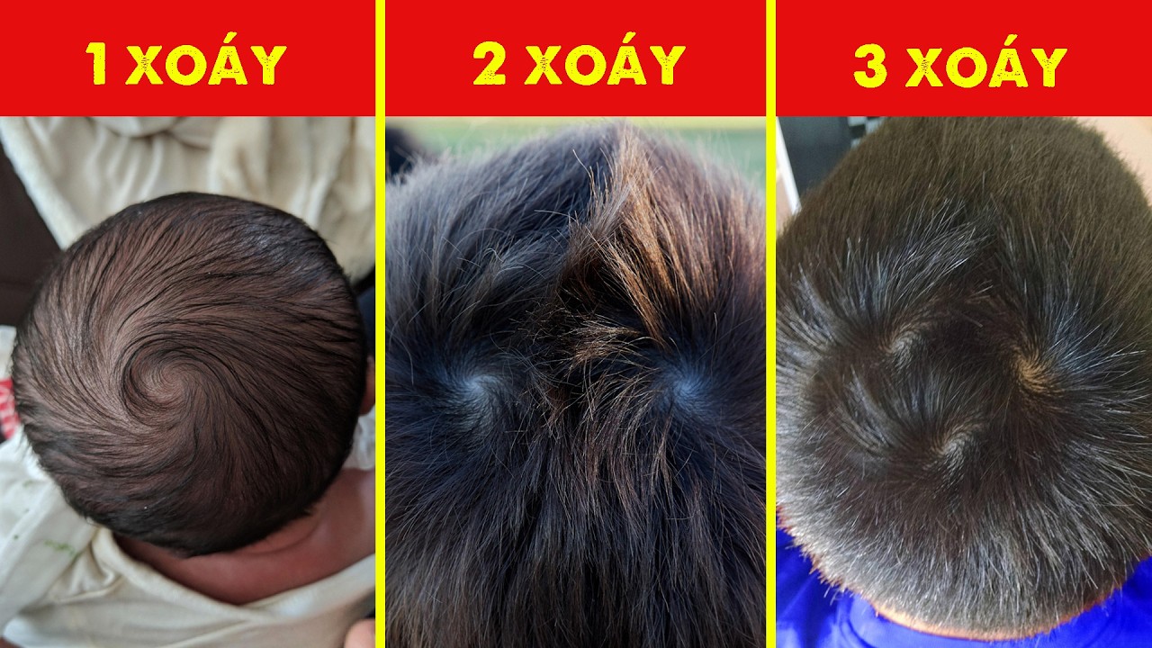 Xoáy Tóc Trên Đầu Bạn Thực Ra Là Một Định Lý Toán Học
