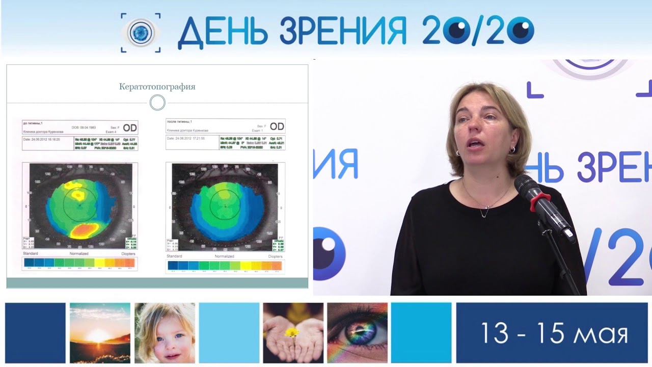 Алгоритм комплексного лечения пациентов с дисфункцией мейбомиевых желез – Полунина Е.Г.
