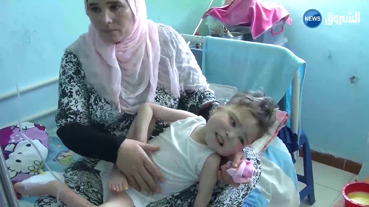 وهران : إسراء... مأساة طفلة ولدت لتعيش في المستشفى