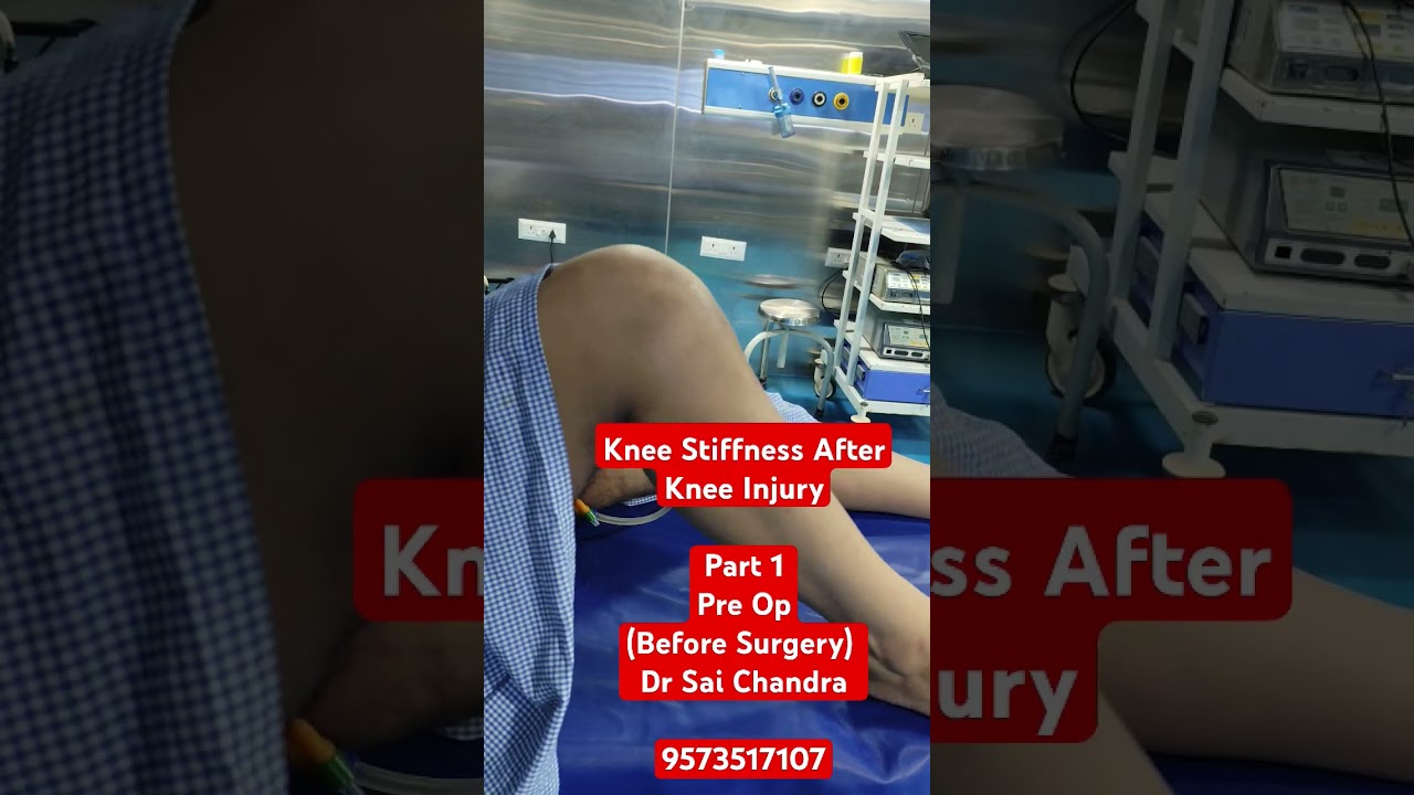 Knee Stiffness After Knee InjuryPart 1Pre Op(Before Surgery) ..Dr Sai Chandra..9573517107