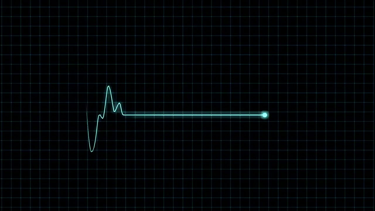Heart Beat with Monitor (20 minutes)