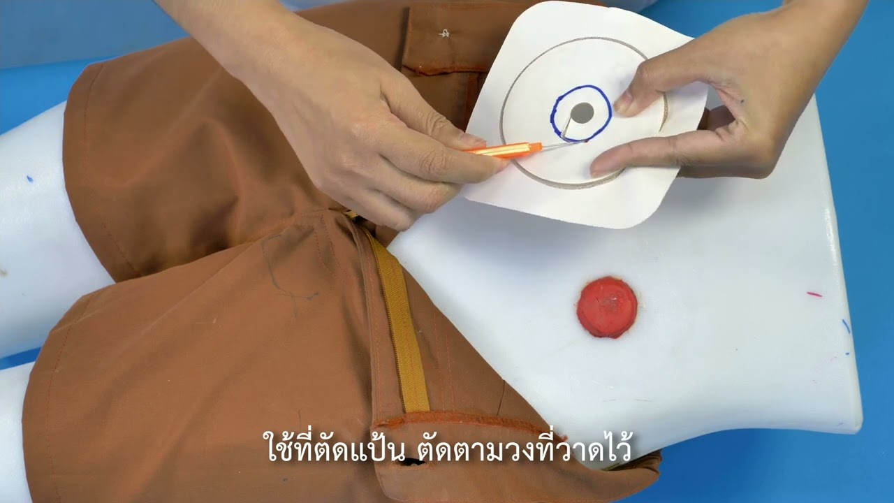 a02การเปลี่ยนถุงรองรับหน้าท้องแบบตีนตุ๊กแก