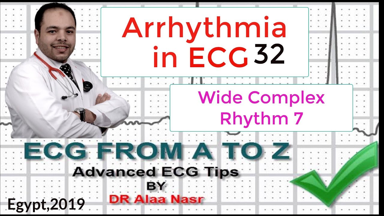 ECG from A to Z, intermediate level, Arrhythmia 32, Dr Alaa Nasr, 201