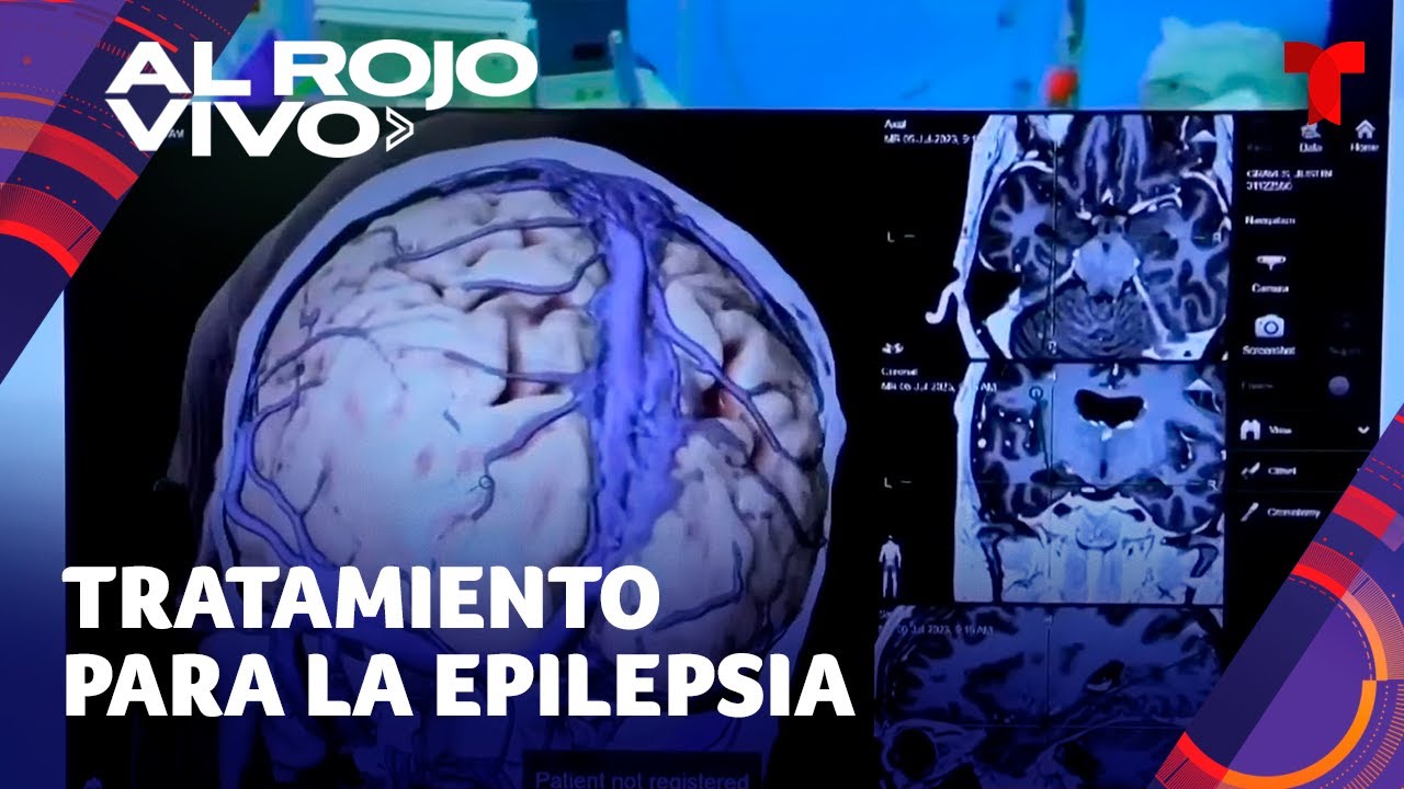 Pacientes con epilepsia tienen esperanza por nuevo tratamiento experimental