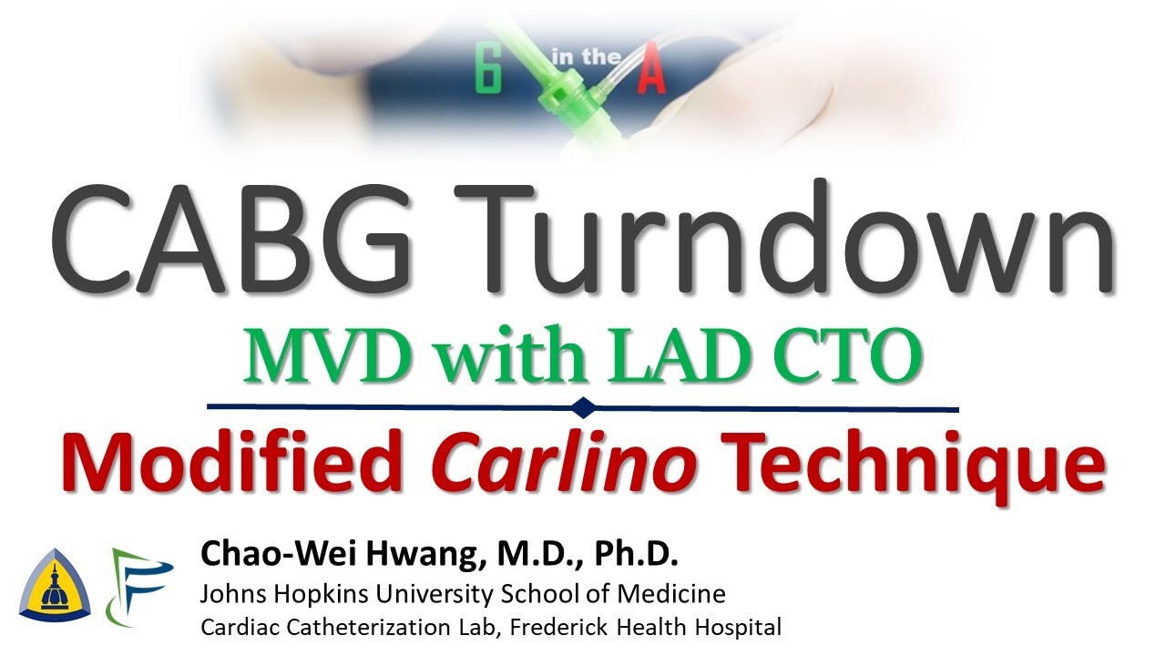LAD CTO with modified Carlino in CABG turndown