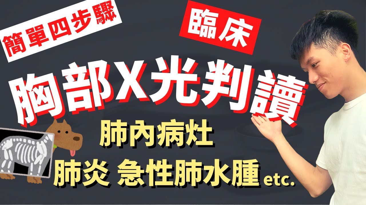 【胸部X光判讀-下集】肺內病灶總整理！簡單四步驟、四種型態搭配簡單流程，第一次拍CXR就上手！各肺葉解剖、肺炎、急性肺水腫、肺塌陷、肺擴張不全、肺栓塞、出血、腫瘤！Chest-X ray善良的路障