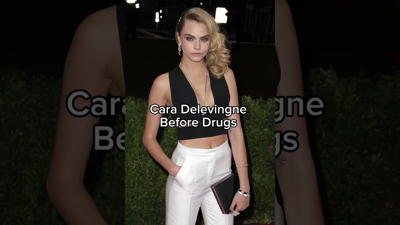 Cara Delevingne before and after drugs 💔 ❤️&zwj;🩹  #modelingagency  #drugaddiction #caradelevingne