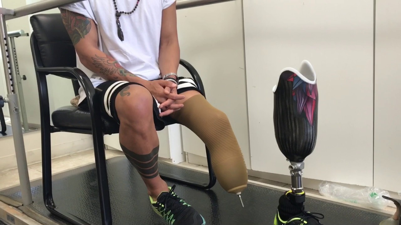 The first steps on the prosthesis. Первые шаги на протезе. Кима Дима. Ощущения. Радость.