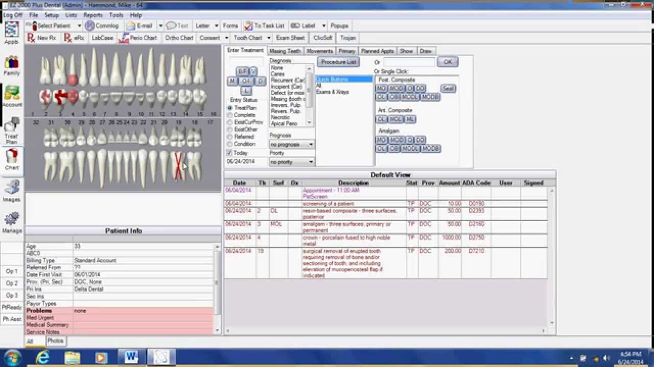 EZ 2000 Plus Dental Software - Treatment Planning
