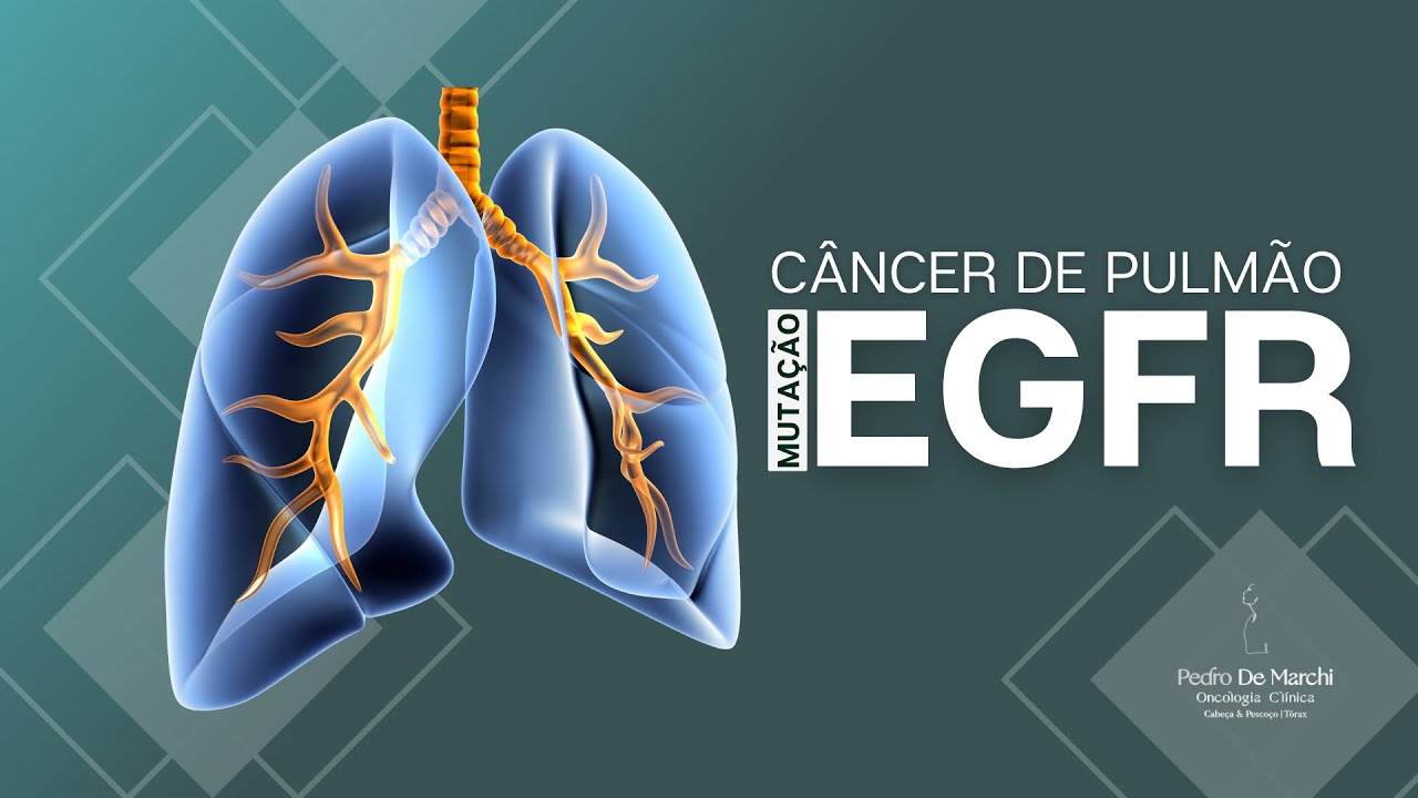 Câncer de pulmão - mutação EGFR