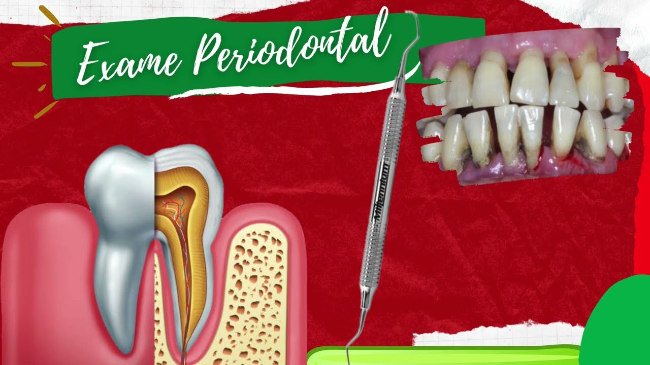 Exame Periodontal e Periograma