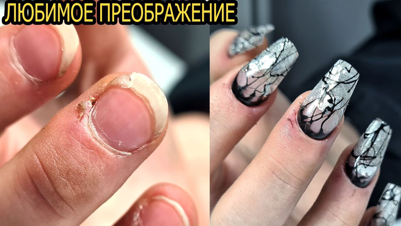 ПРЕОБРАЖЕНИЕ ногтей МОДЕЛИ ❤ COSMOPROFI ❤ ОГРОМНЫЙ заусенец с КРОВЬЮ