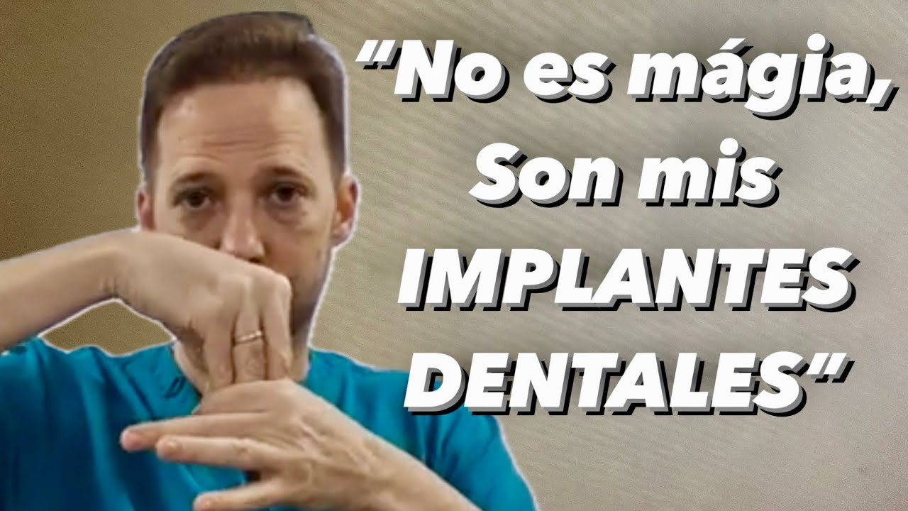 ⚠️NO CAIGAS EN EL ERROR: TE EXPLICO los Tipos de IMPLANTES DENTALES Y lo que NADIE TE HA CONTADO