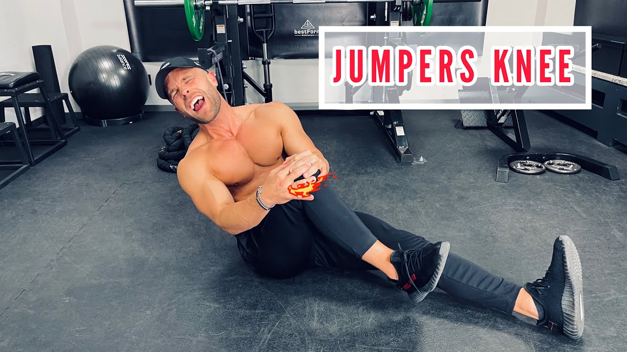 🚨JUMPERS KNEE🚨 PATELLASPITZENSYNDROM?KNIESCHMERZEN LOS WERDEN?! MACH DAS!