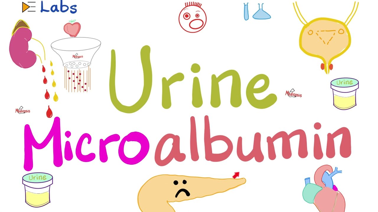 Микроальбумин в моче (микроальбуминурия) – сахарный диабет и заболевания почек – нефрологические ...