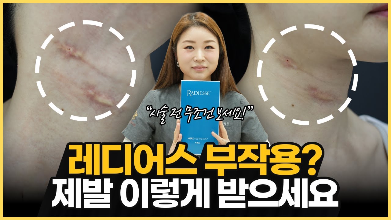 콜라겐 부스터 레디어스의 모든 기준｜효과·지속력·부작용 정리