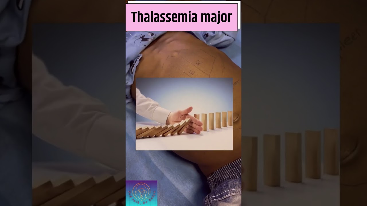 #thalassemia #prevention #awareness #parents