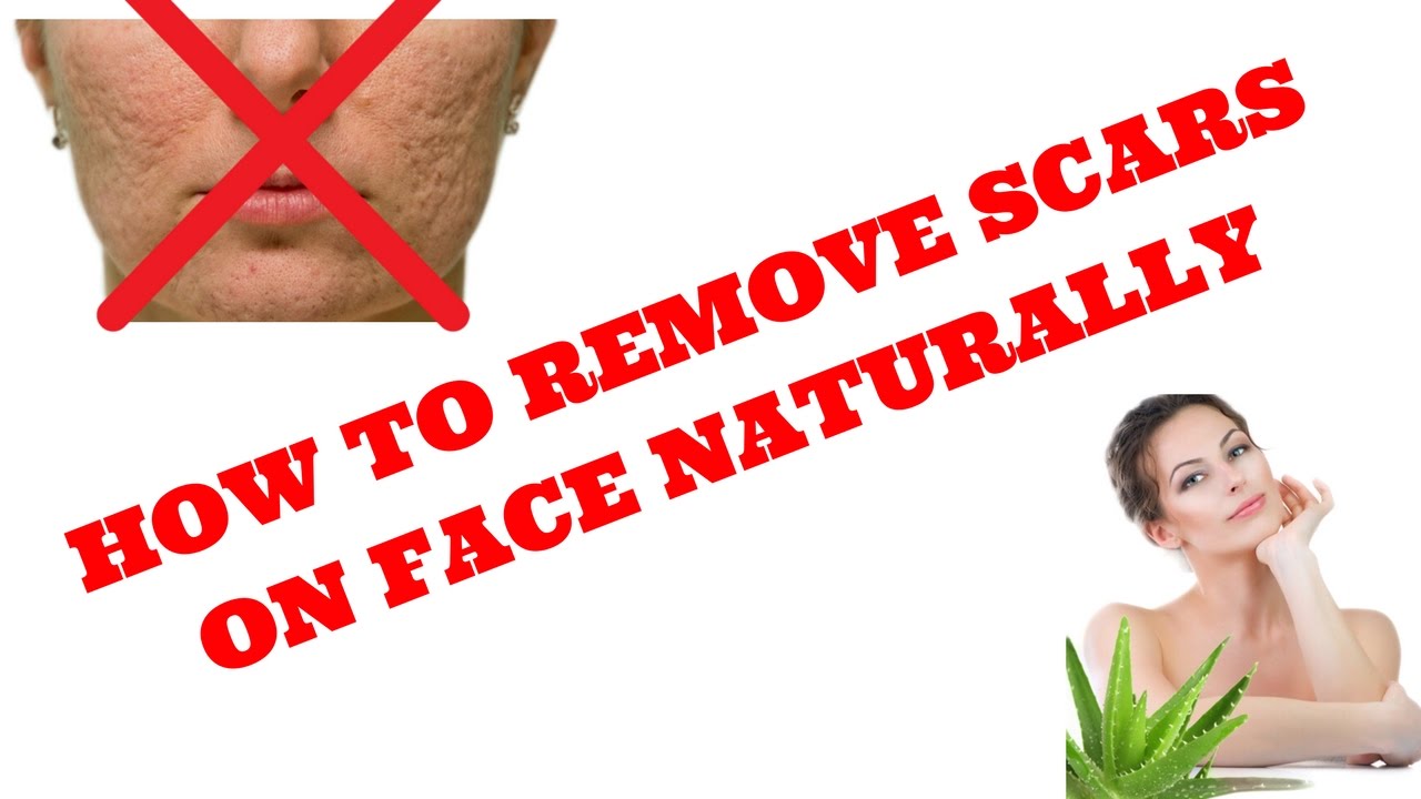 HOW TO REMOVE SCARS ON FACE NATURALLY